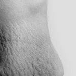 Body After Baby